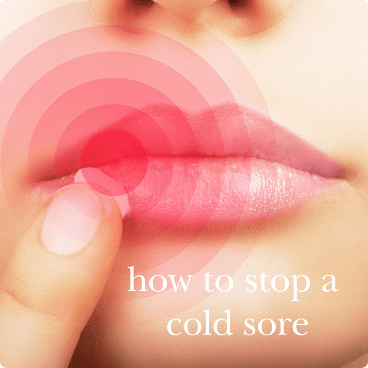 get-rid-of-cold-sores-fast-naturally-camp-wander